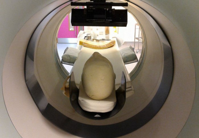 kinect camera in brain scanner