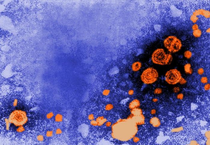 Hepatitis B virions with Dane particles