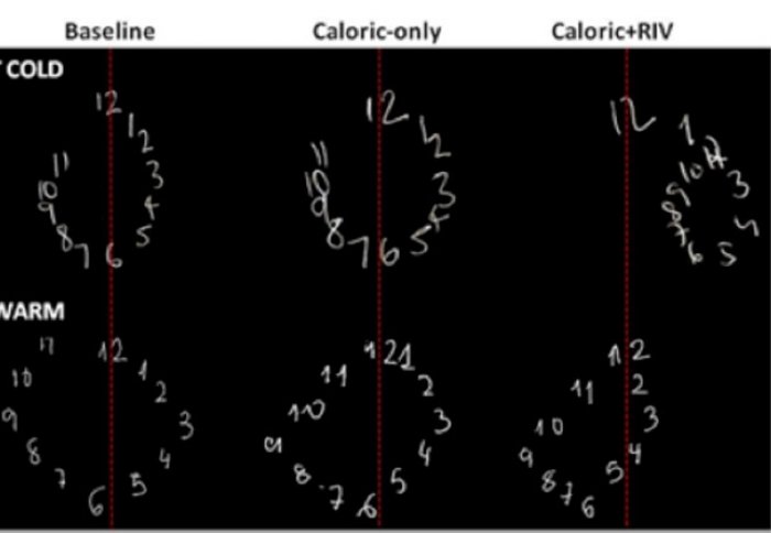 Clock faces in the experiments