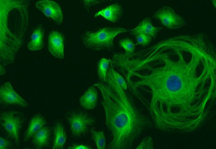 Breast cancer cells in the study