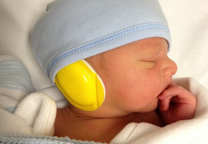 Baby James wears special ear muffs before going into the MRI scanner