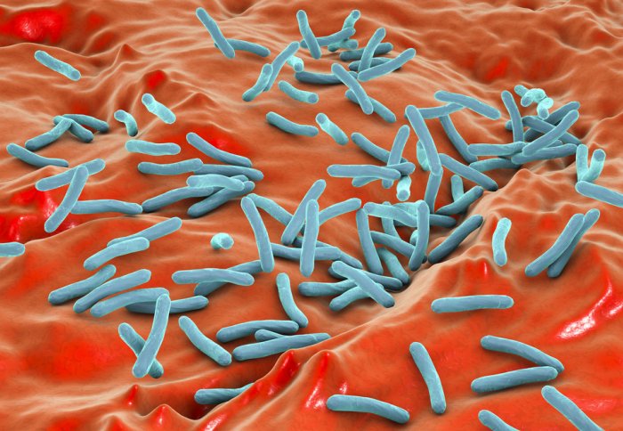 Myobacterium tuberculosis