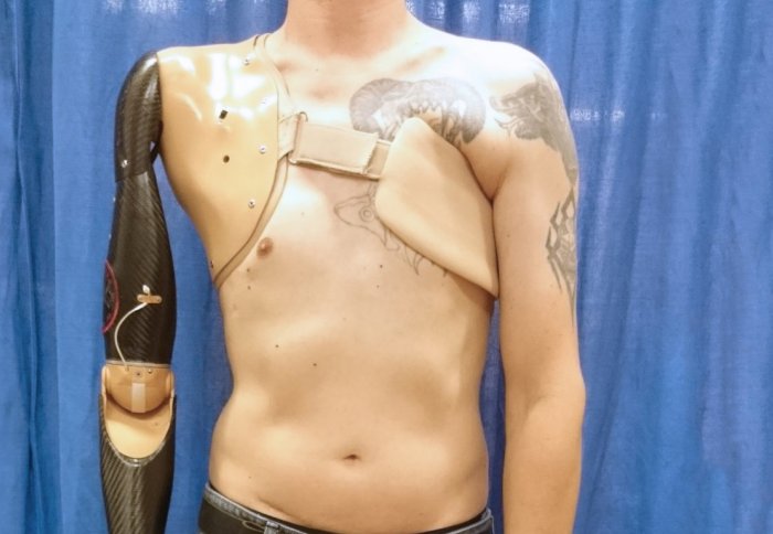 The robotic prosthetic on the right is controlled by the sensor under the left arm