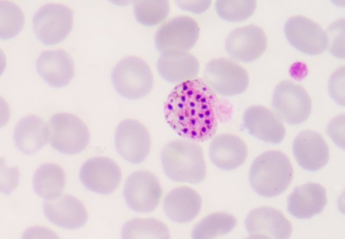 Blood films for Malaria parasite: show malaria pigment
