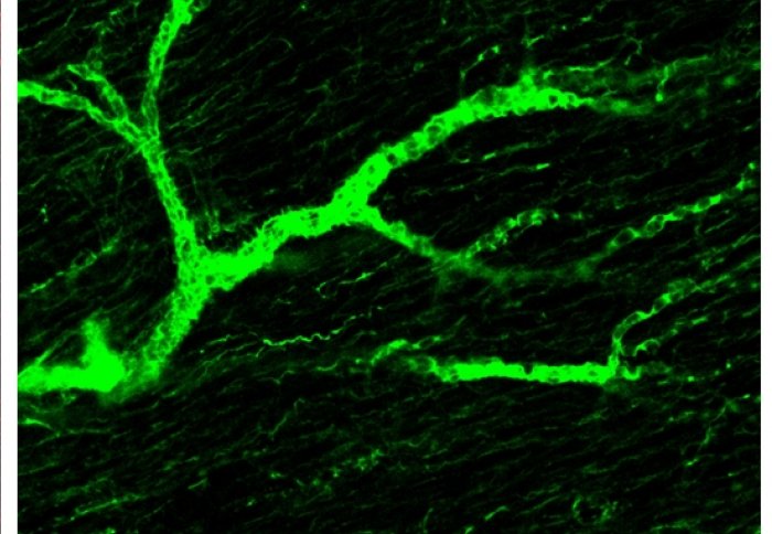 An approach used for making brain tissue transparent is helping to reveal the fine blood vessels of the heart