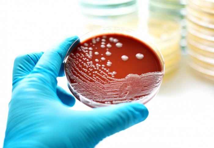 Scientist holding N. gonorrhoeae on chocolate agar plate with gloved hand