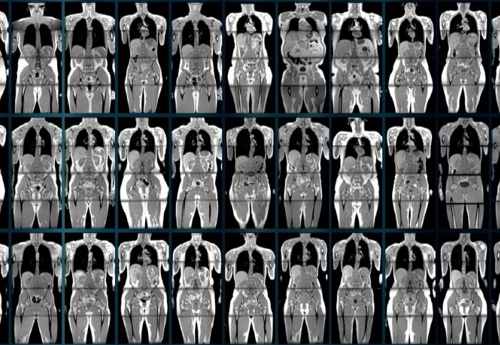 Lots of black and white scans of bodies