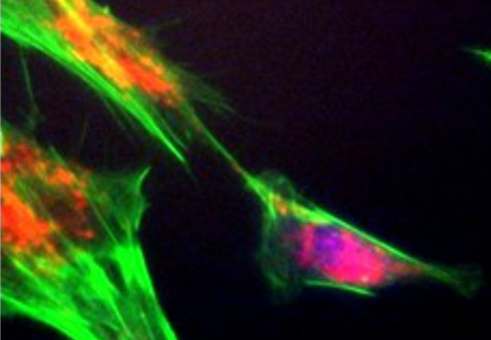 Stem cell therapy could treat damaged lung cells (bottom right)