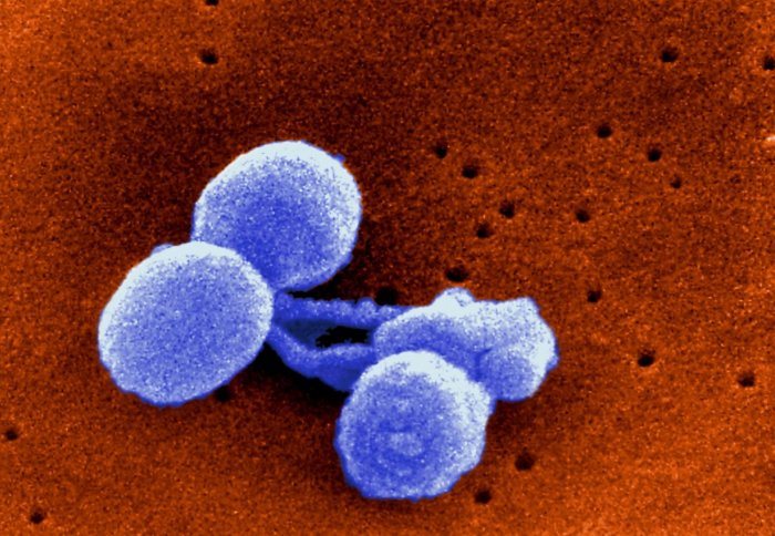 pneumococcal bacteria