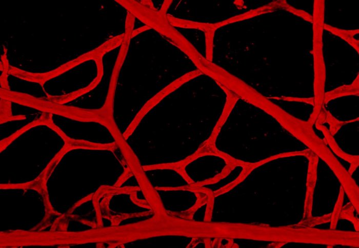 Vascular network