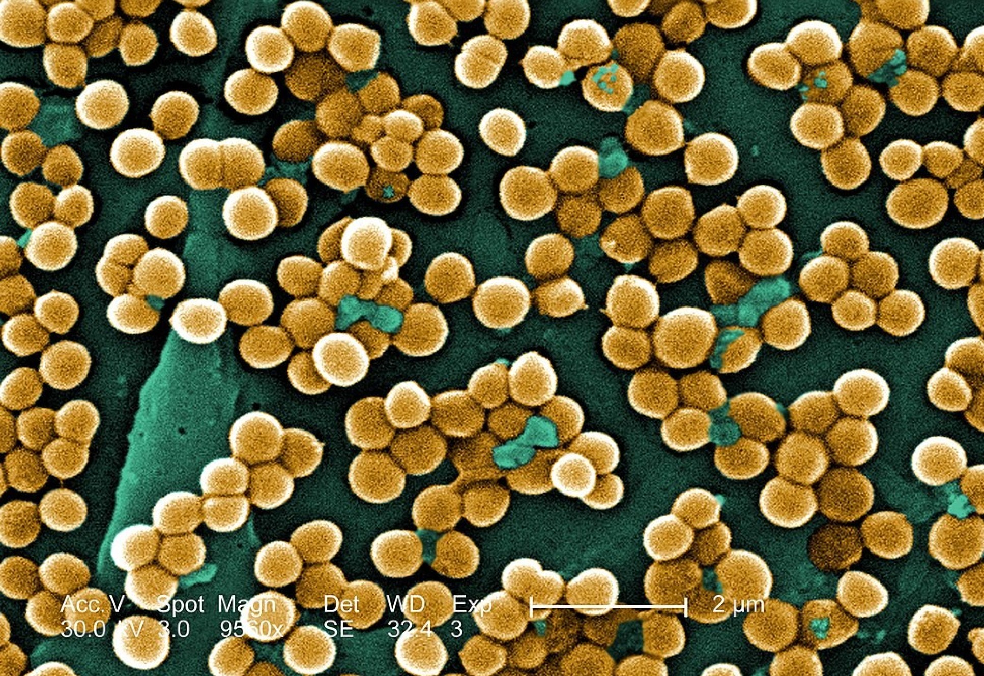 MRSA bacteria