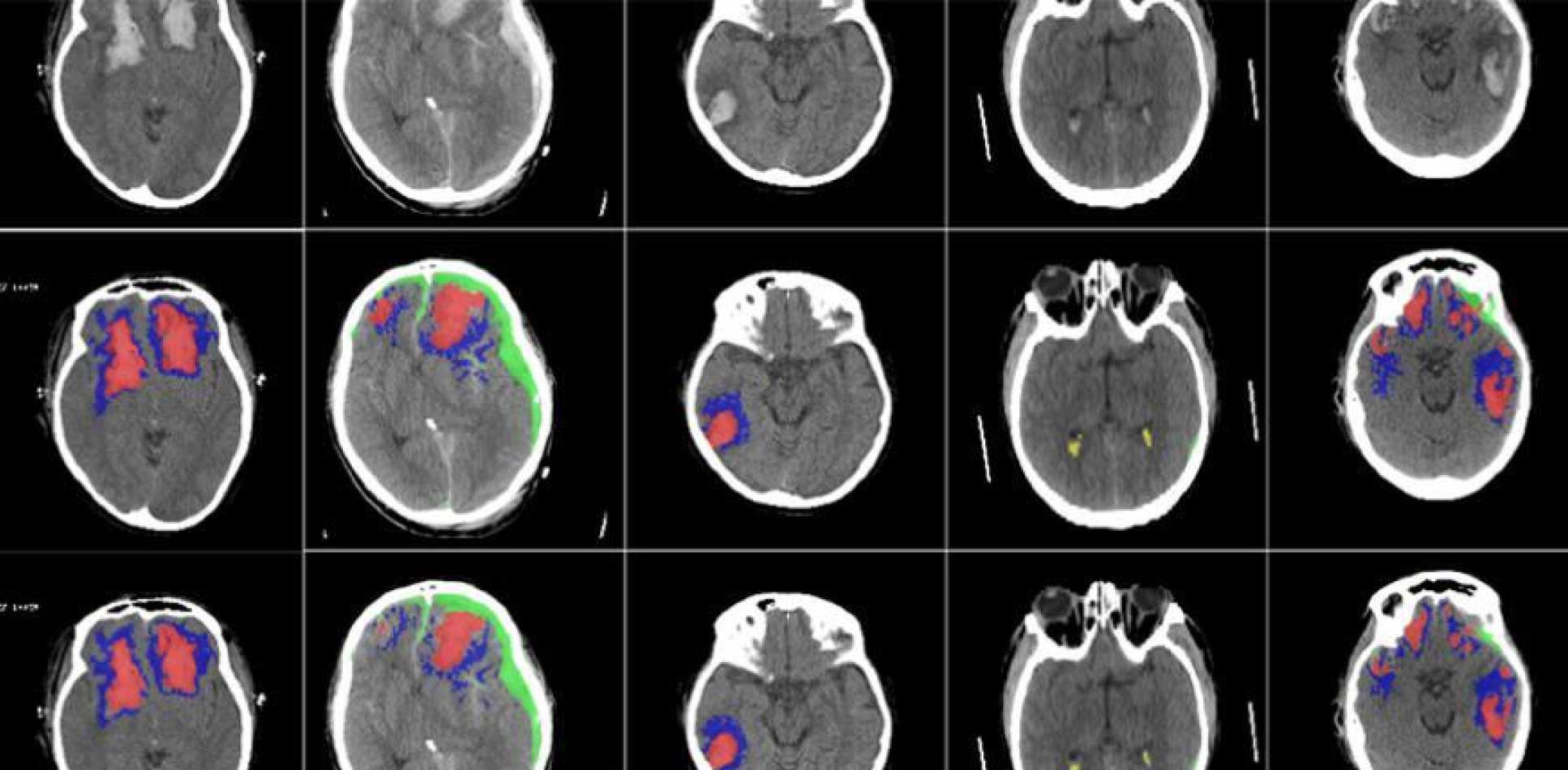 Image of brain scans processed by the machine learning algorithm