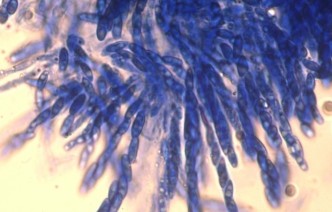 Fungal spores under the microscope