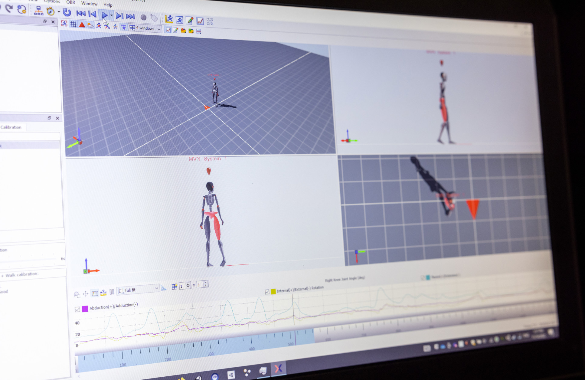 Computer screen showing motion capture stick figures fed into by the patient