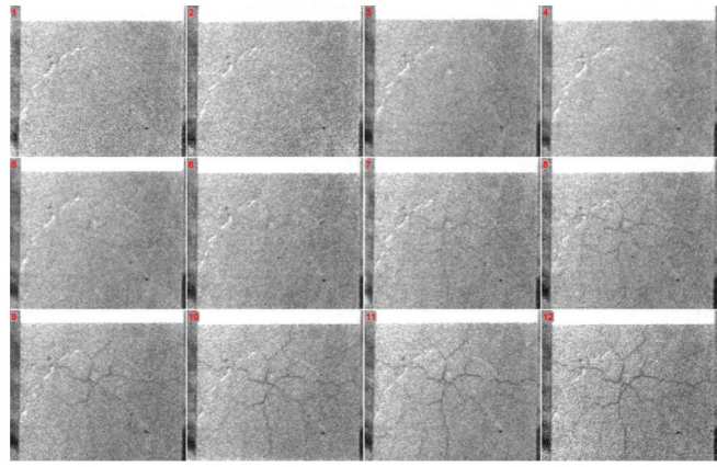 Figure 33: A sequence of high speed photographs showing crack formation on the rear side of an explosively loaded concrete slab.  Cracks are first visible in frames 6 or 7, corresponding to approximately 270 – 310 microseconds after detonation. The large scale explosive tests were complemented by a series of smaller scale explosive tests at IEM and plate-impact experiments in collaboration with ISP characterising the shock response of the concrete