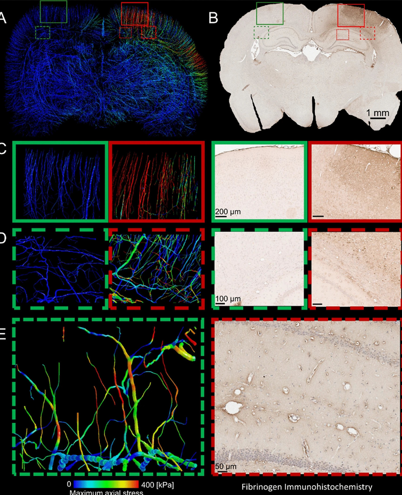 Zoomed in brain images show detailed vasculature