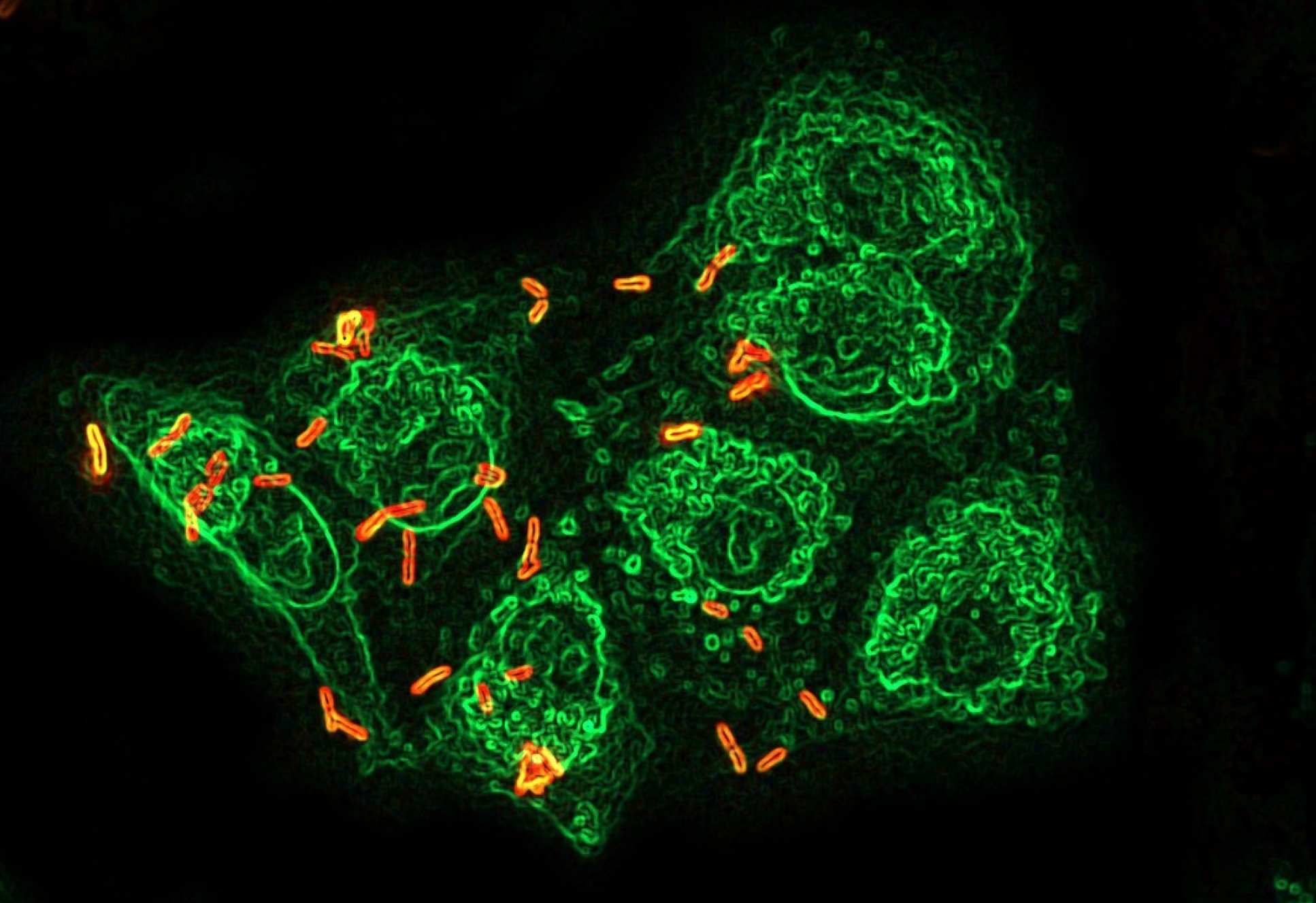  This image illustrates Pseudomonas colonization of the host lung tissue.