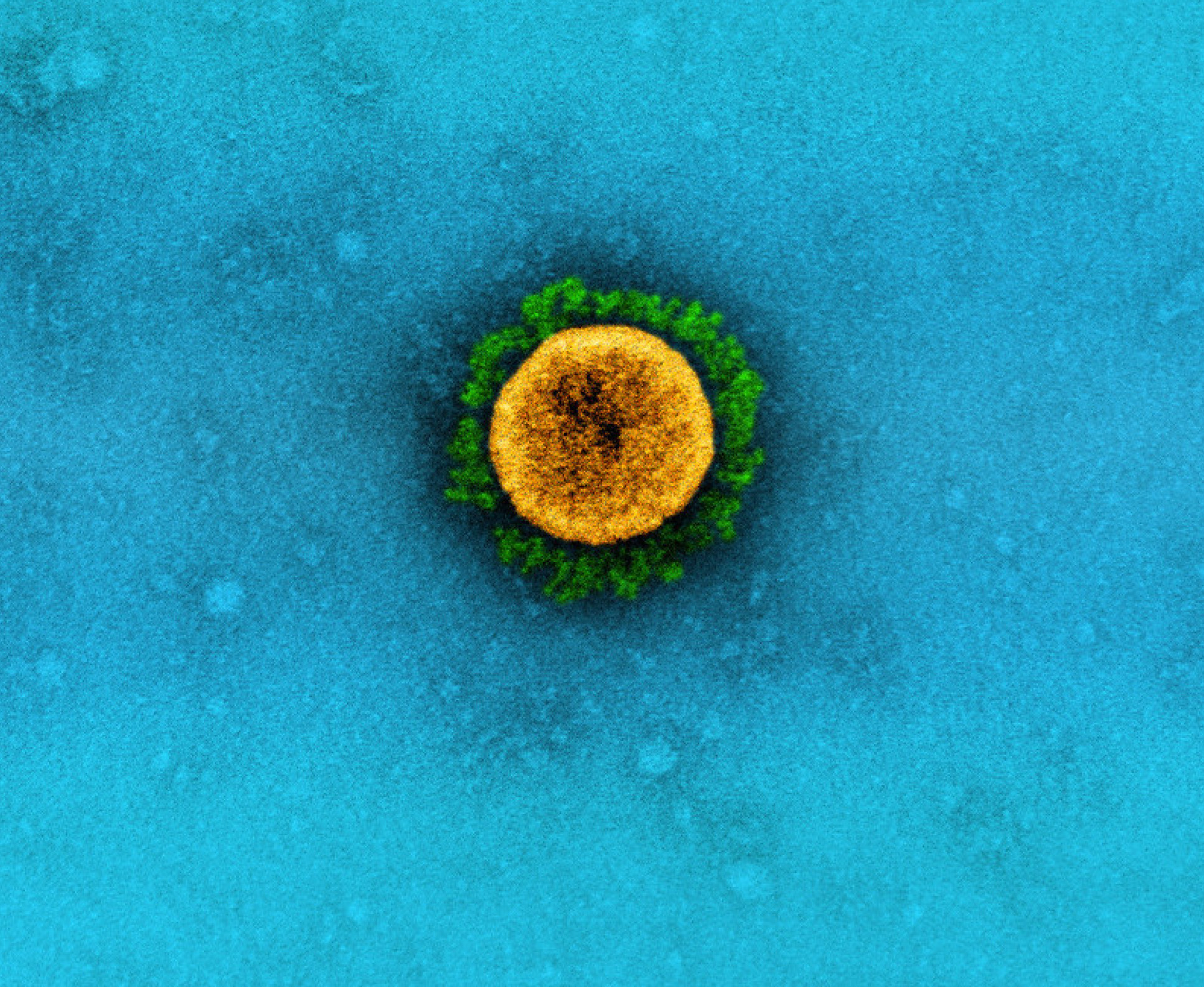 SARS-CoV-2 coronavirus