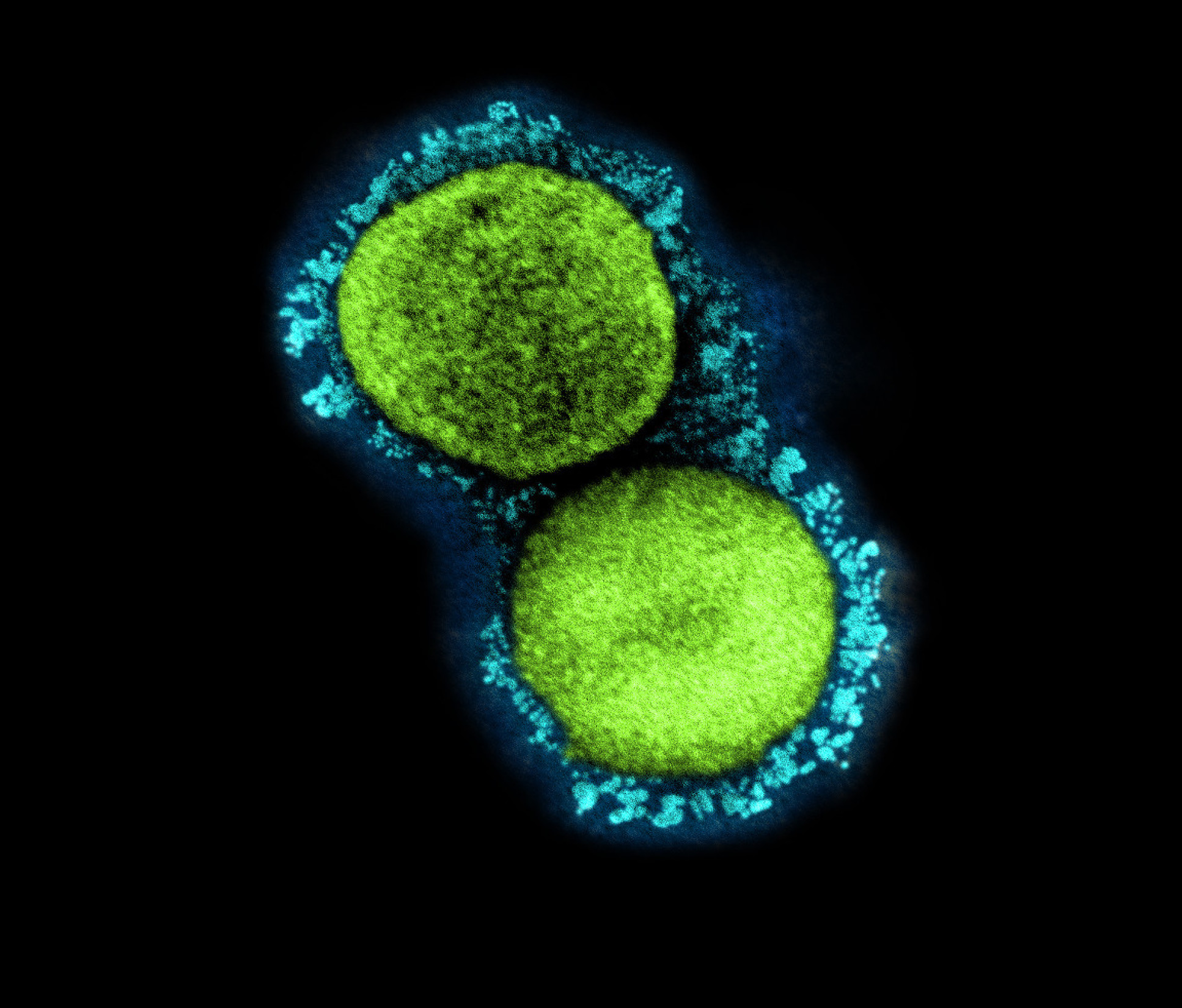 SARS-CoV-2 coronavirus