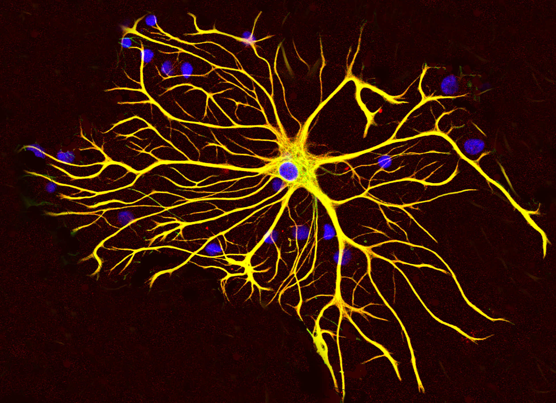 A microscopic image of an astrocyte cell 