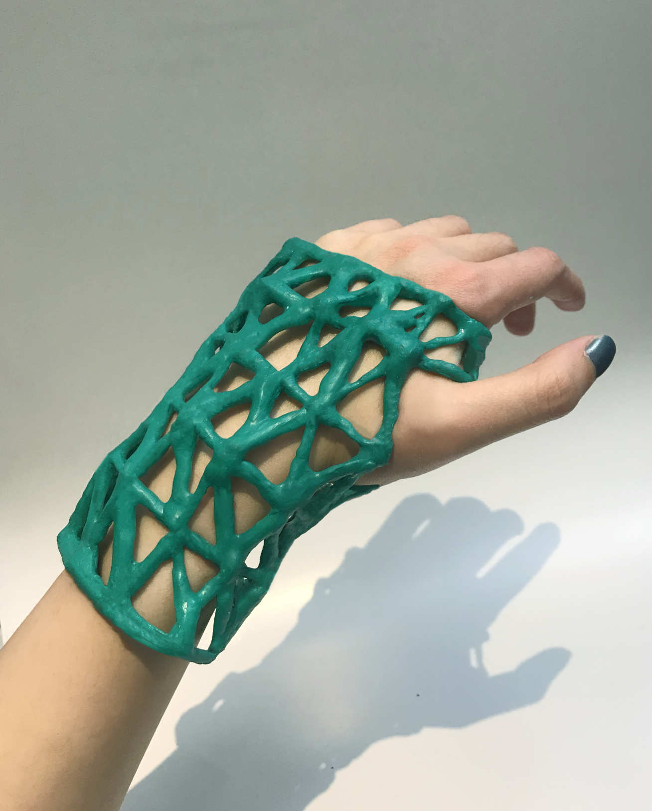 Next-generation washable cast for broken limbs wins WE Innovate top ...