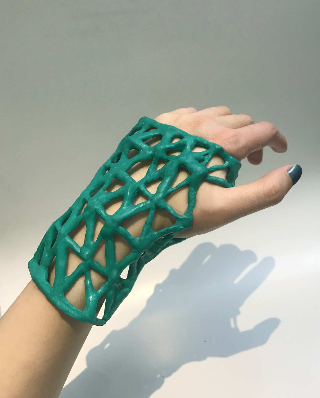 This 3D printed cast could be the future of healing broken bones