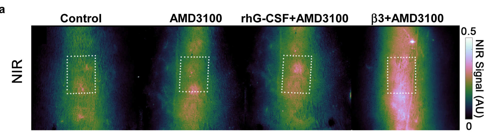 This image shows repair of the spine three weeks after surgery. The image on the left is with no drug treatment, with the image on the right (b3+AMD3100) showing the effect of the two drug treatments. The red colour indicates calcium incorporating into the bone, which is associated with enhanced healing.