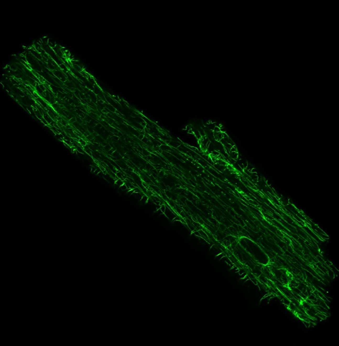 Microtubules