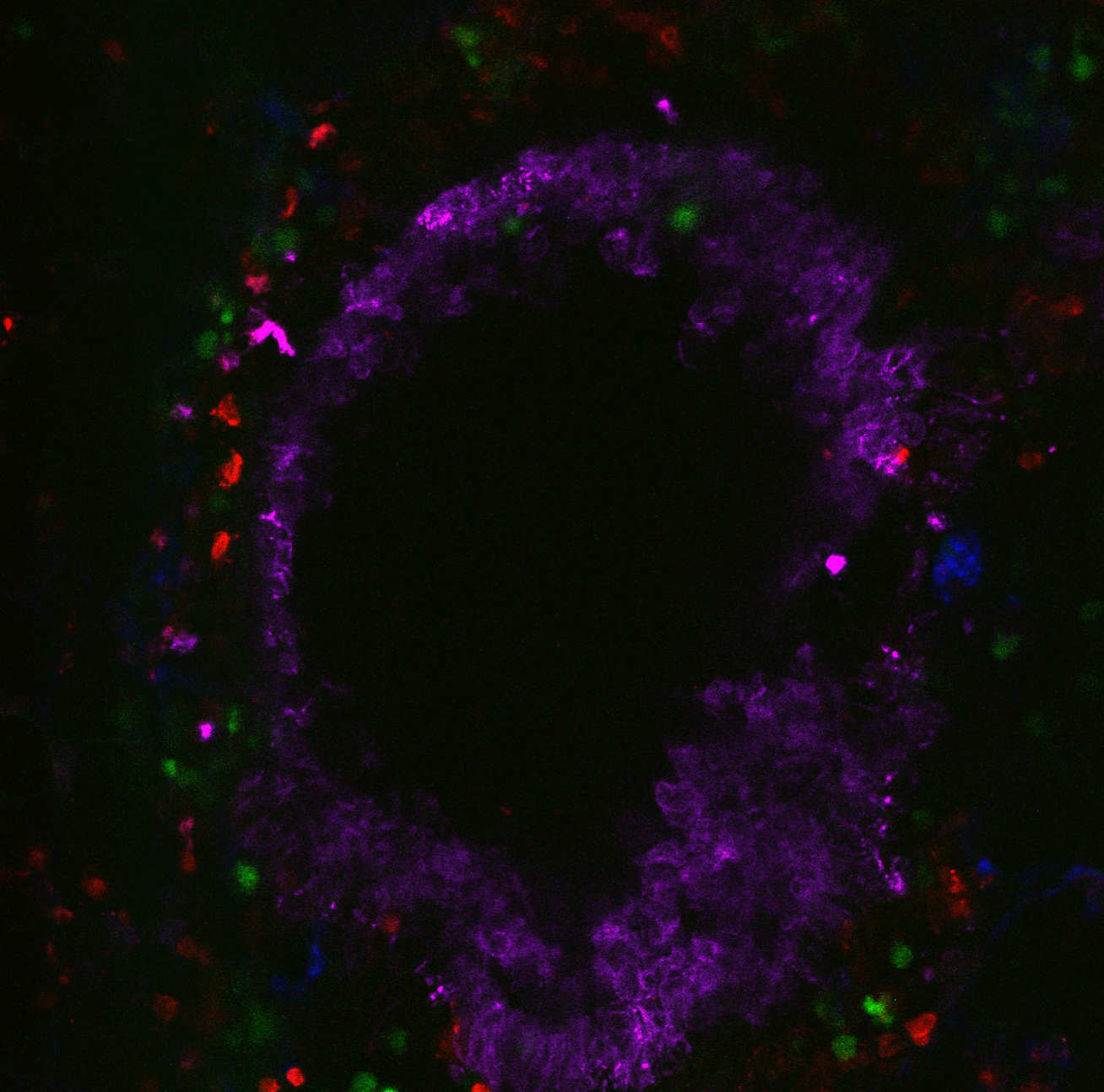 : Neutrophils (Red) and Type 2 innate lymphoid cells (Green) surround the airways (Magenta) and blood vessels (Blue) during allergic inflammation