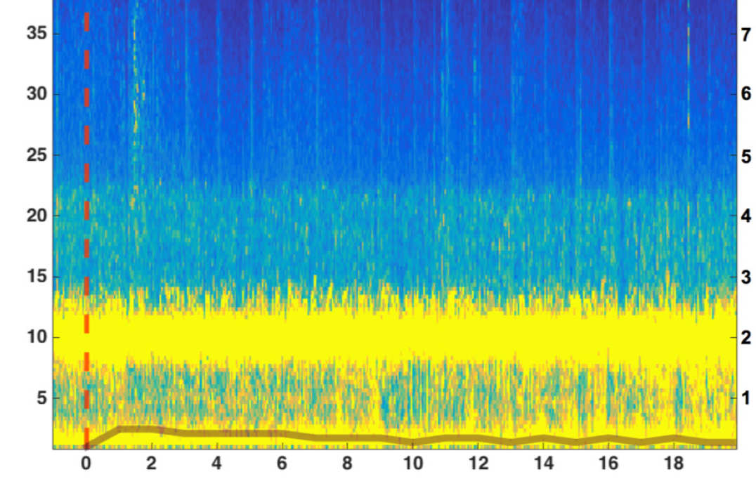 Brain activity measured under placebo conditions shows consistent peaks and troughs of electrical activity