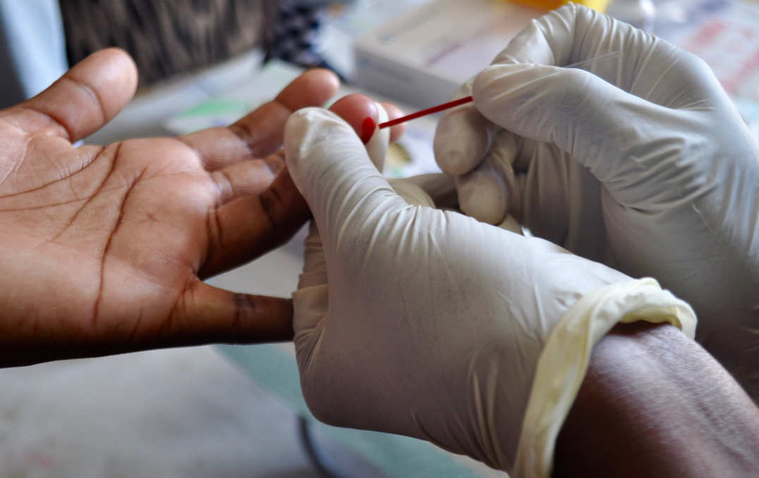 Snapshots from the trial to treat HIV and TB