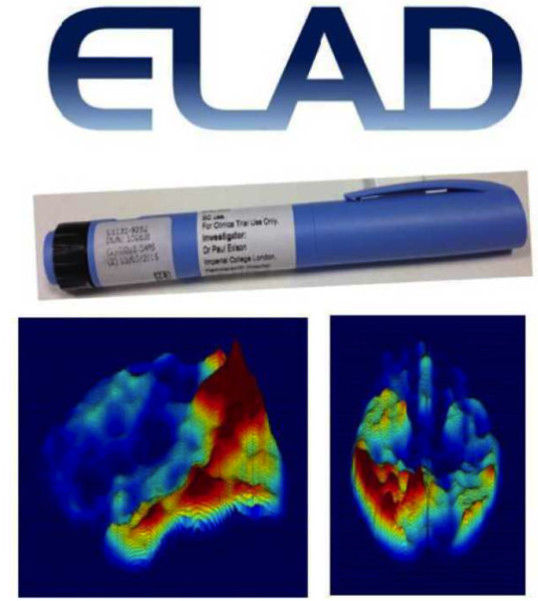 Liraglutide in Alzheimer's disease