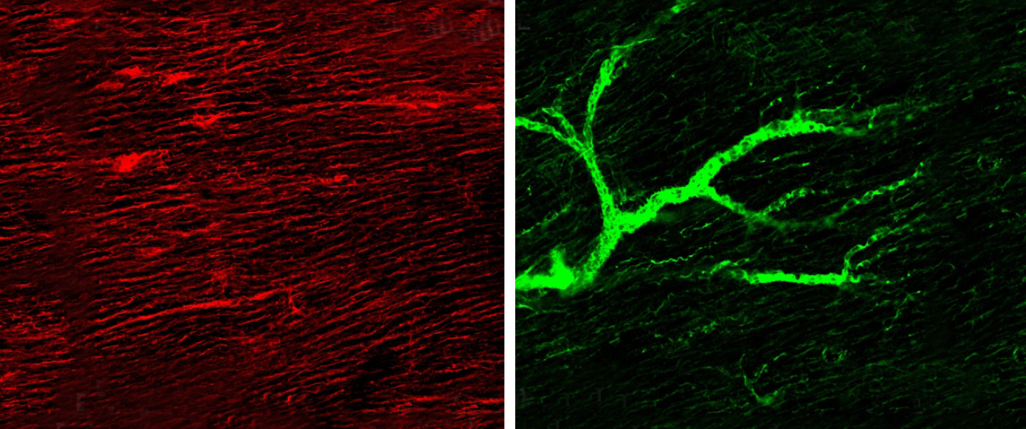 Images of heart tissue