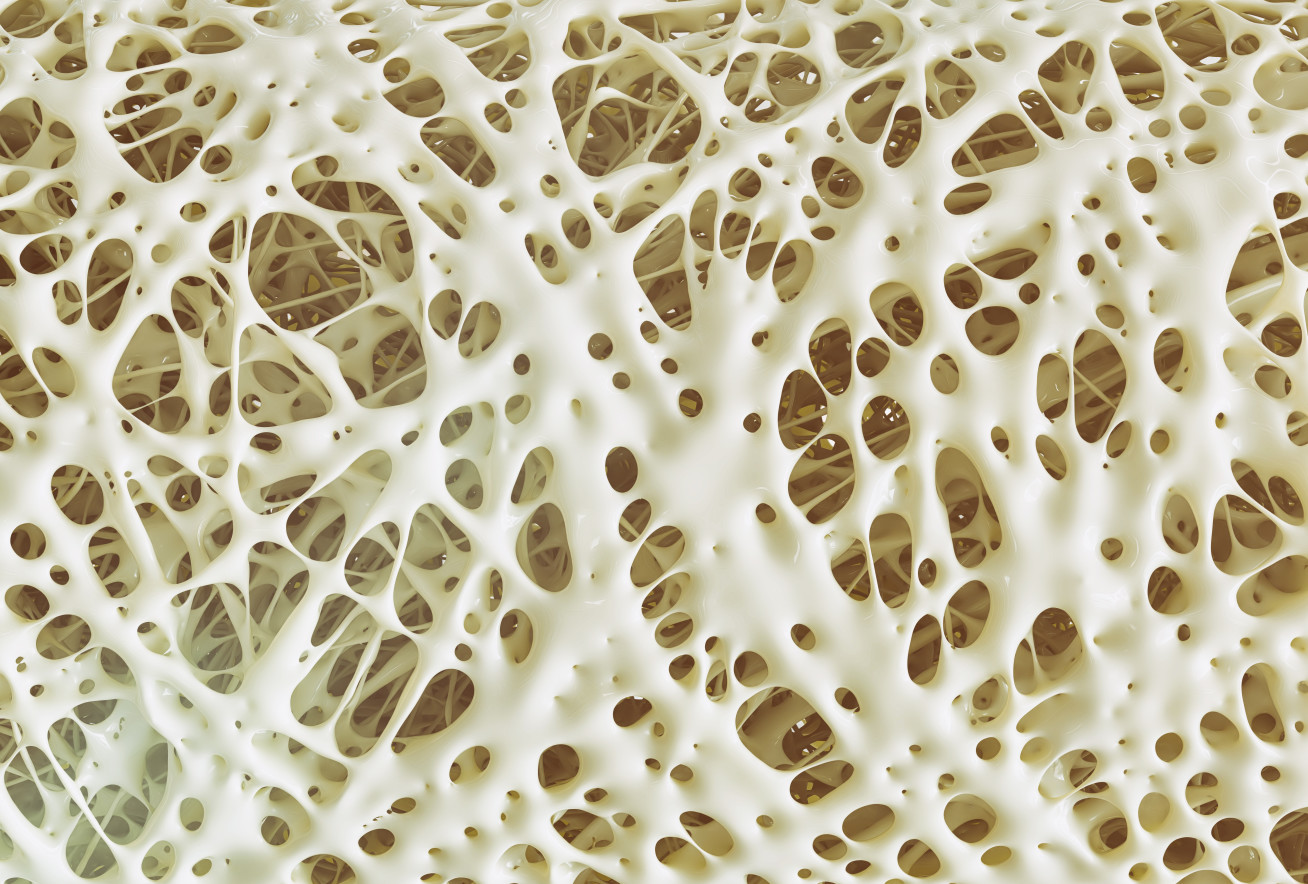 Porous bones under the microscope
