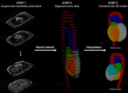 Automated MRI analysis