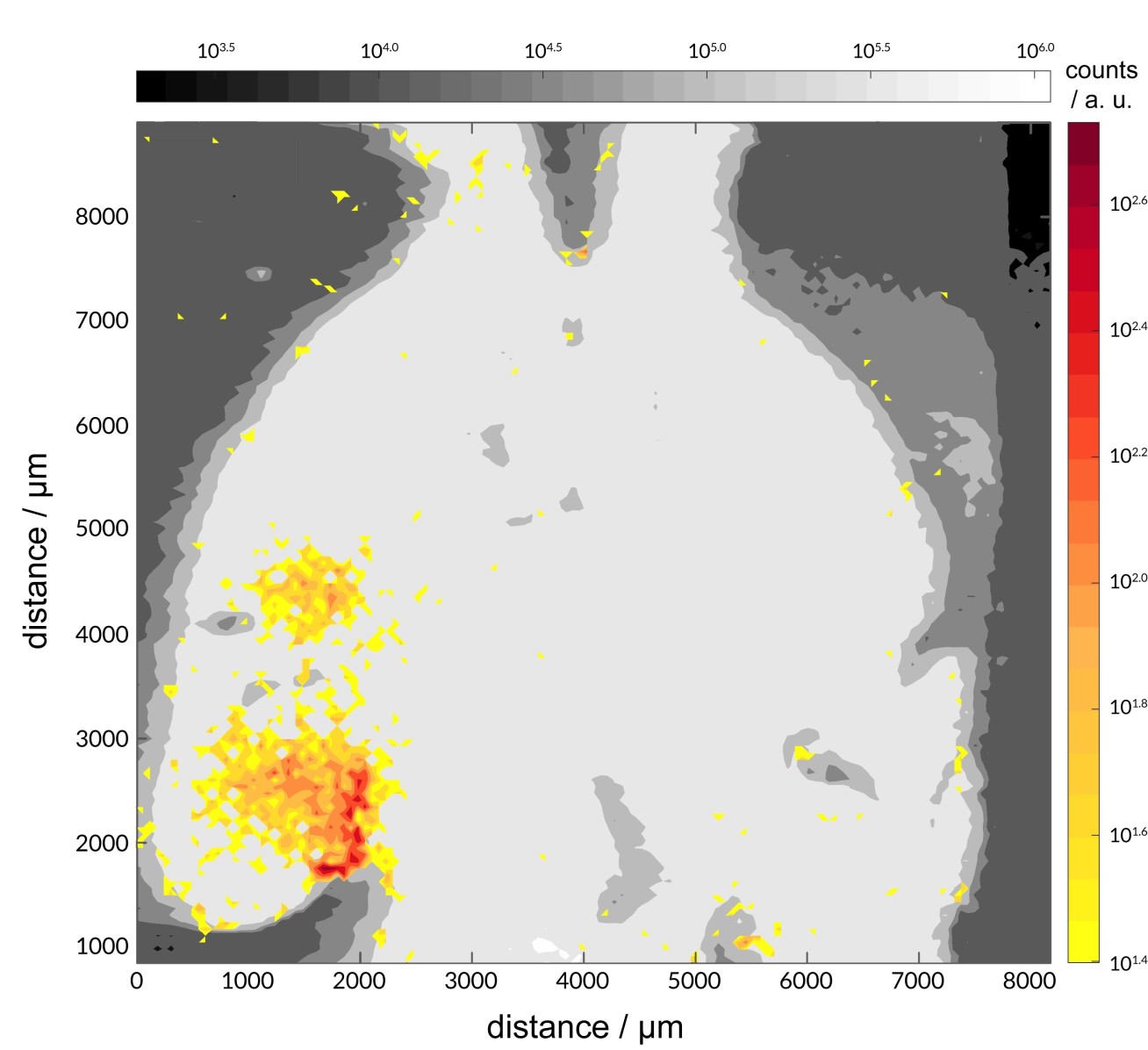 Greyscale image of a brain with yellow and red highlighted areas