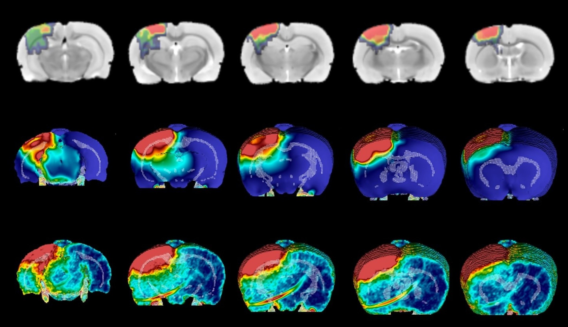 Photo of several brain scans