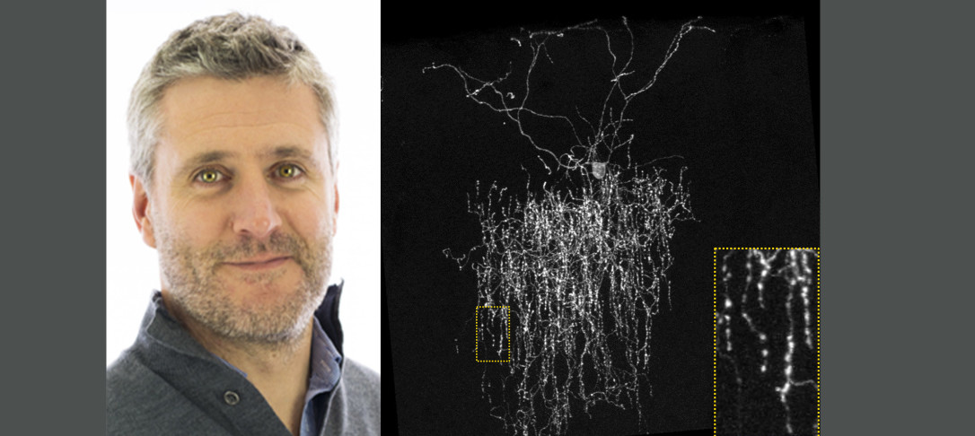 juan burrone and chandelier cell