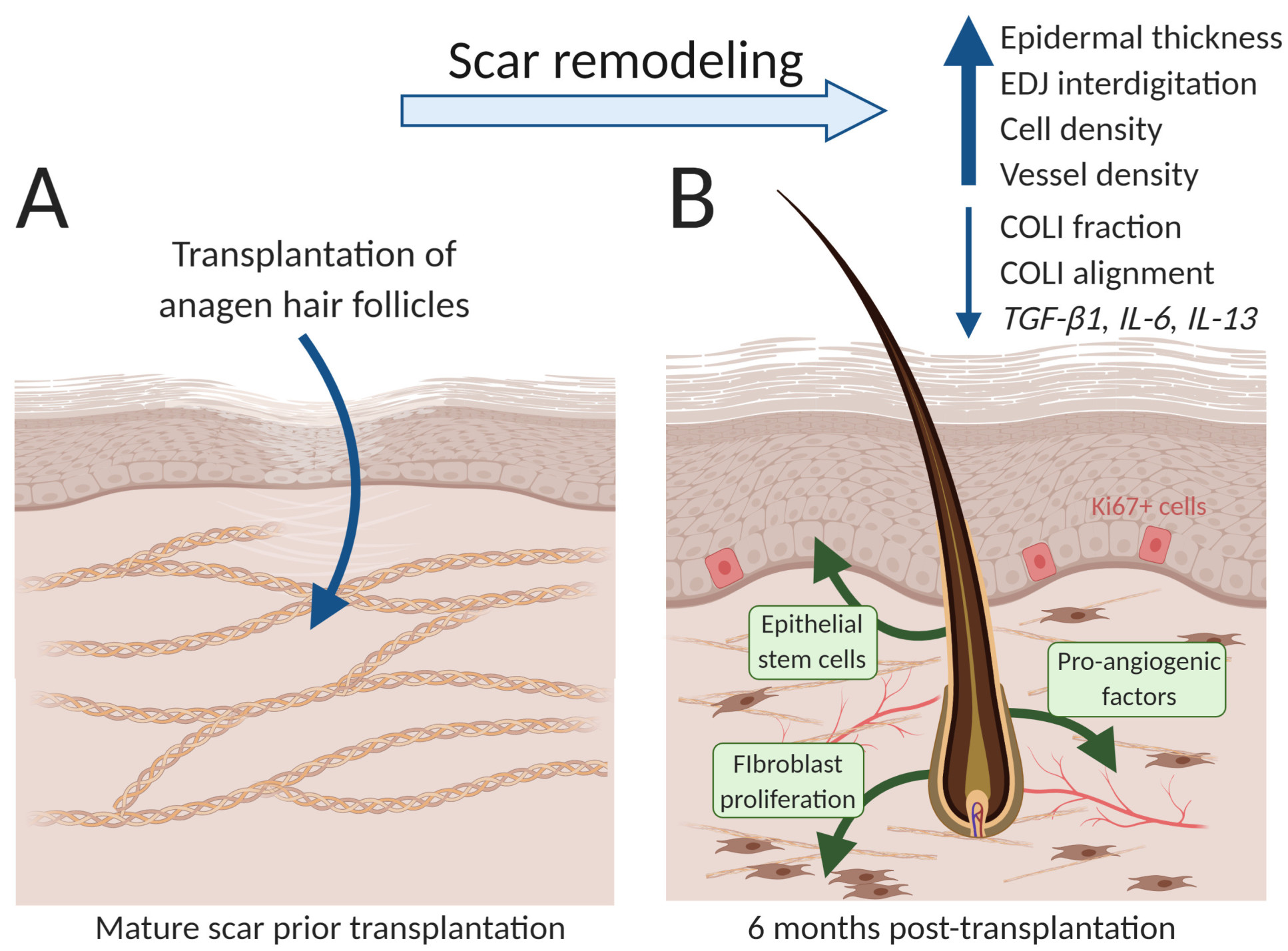 Schematic of results showing how the transplants promoted scar rejuvenation. Before and after diagrams displaying new cells and blood vessels, collagen remodelled into healthy patterns, and upregulated genes found in healthy unscarred skin.