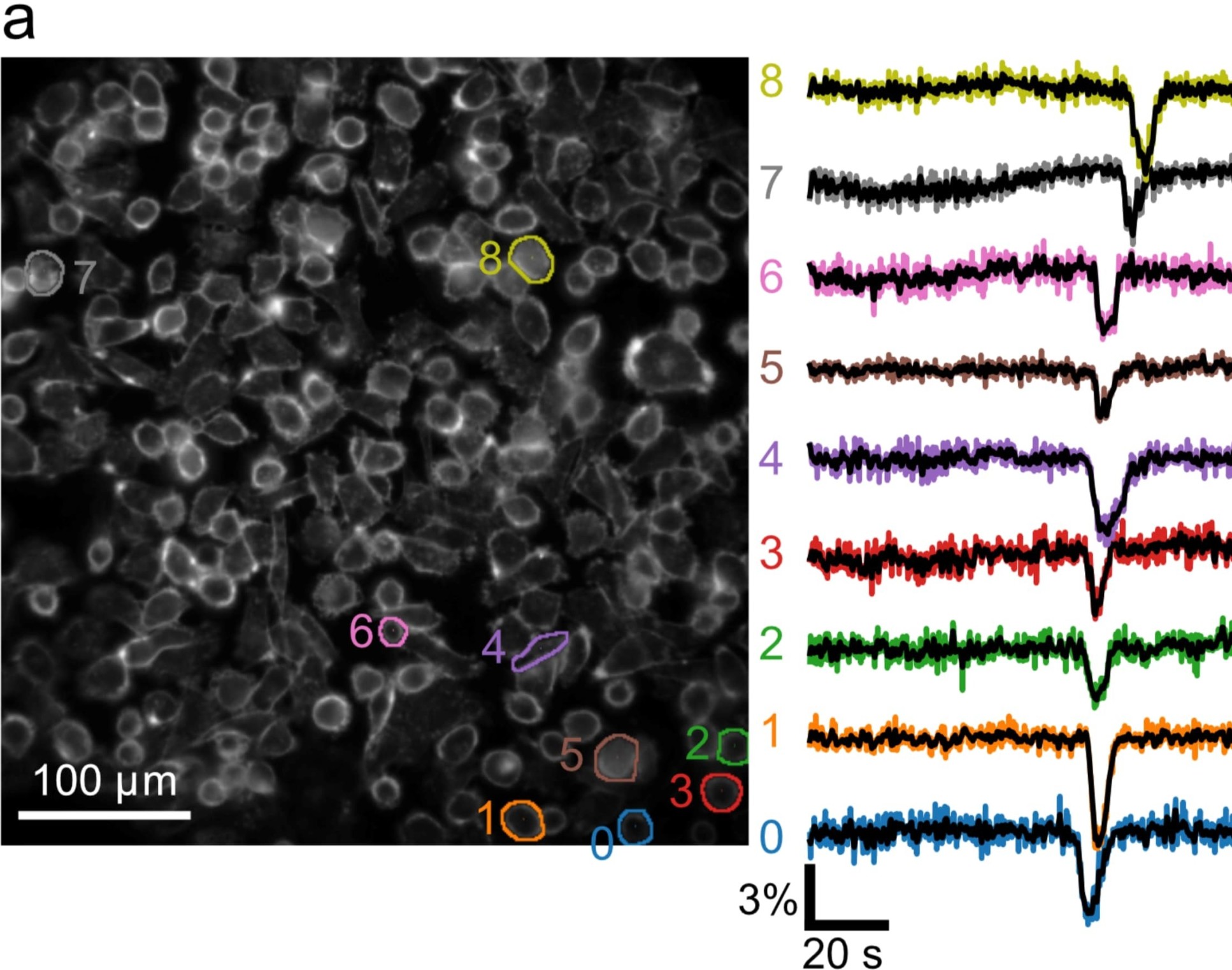 A wave of voltage fluctuations seen across the cells