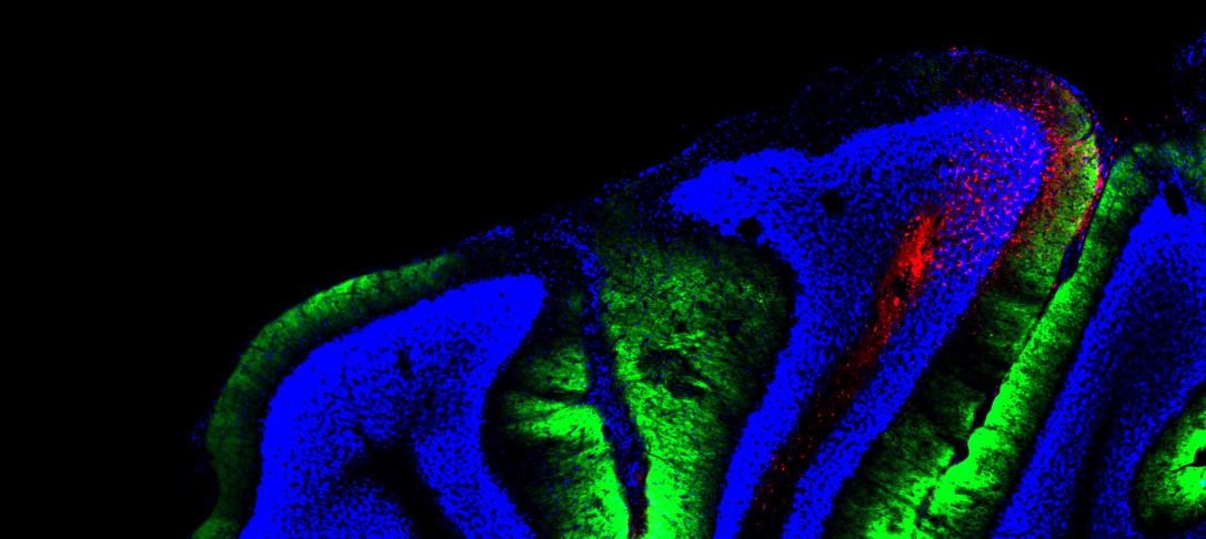 brain image narain lab