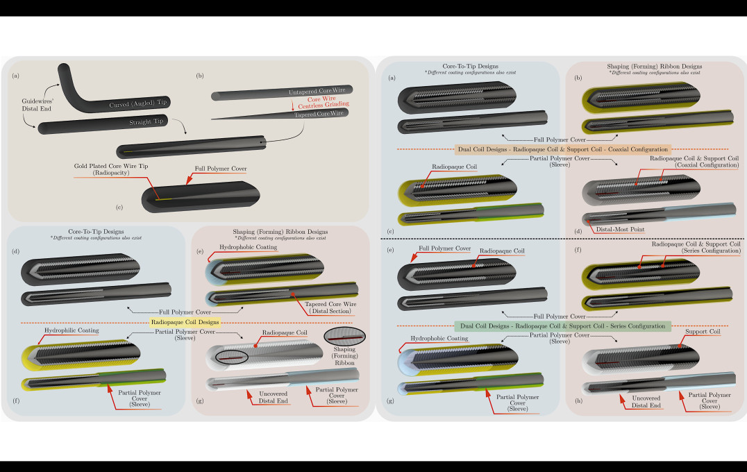Guide-wire Classification: [LEFT] (a) Two different types of commonly used guidewire tips (distal ends): curved (angled) and straight. The distal ends tend to be heat treated to set the desired shape, e.g.‘J’-shape. (b) The transition from an untapered to a tapered core wire using centreless grinding to achieve the desired taper profile across the distal end in (c). For (c)–(g), a sectioned view of the distal end of commercially available guidewires and their corresponding insets, illustrating the core design and its surrounding elements (coils, ribbons, etc). (c) Guidewire widely used in peripheral interventions (Radifocus Guidewire (Terumo Europe NV, Leuven Belgium)). This type has a core-to-tip design and is fully covered with polymer. For radiopacity, the tip is plated with a radiopaque material (gold in this illustration). (d)–(g) Guidewires comprising a radiopaque coil instead of the aforementioned radiopaque plated core tip. Classification based on polymer covering: (d) and (e) guidewires covered fully with polymer, and (f) and (g) guidewires partially covered with polymer. Classification based on core design: (d) and (f) core-to-tip design, and (e) and (g) shaping/forming ribbon design. Guidewire coating: (b) has an additional layer of hydrophilic polymer that is added to improve lubricity, trackability and manoeuvrability. On the other hand, (e) employs a hybrid approach by coating the distal-most point with a hydrophobic polymer (e.g. silicone) to enhance tactile feedback and tip control. Note: The illustrated examples are merely a few examples of commercially available coating configurations. | [RIGHT] (a)–(h) Guidewires comprising a radiopaque coil and an additional support coil to promote the tip’s resilience and mechanical properties. A sectioned view of the distal end of commercially available guidewires and their corresponding insets, illustrating the core design and its surrounding elements (coils, shaping ribbon). Classification based on support coil placement: (a)–(d) coaxially placed support coil (commonly stainless steel) with respect to a radiopaque coil, and (e)–(h) support coil placed in series with respect to a radiopaque coil. Classification based on polymer covering: (a), (b), (e) and (f) guidewires fully covered with polymer, and (c), (d), (g) and (h) guidewires partially covered with polymer. Classification based on core design: (a, c, e and (g) core-to-tip design, and (b), (d), (f) and (h) shaping/forming ribbon design. Guidewire coating: (b), (c) and (f) have an additional layer of hydrophilic polymer to improve the guidewires’ lubricity, trackability and manoeuvrability. Conversely (g) employs a hybrid approach by applying a hydrophobic polymer (e.g. silicone) at the distal-most point to enhance tactile feedback and tip control. Note: The illustrated examples are merely a few examples of commercially available coating configurations.