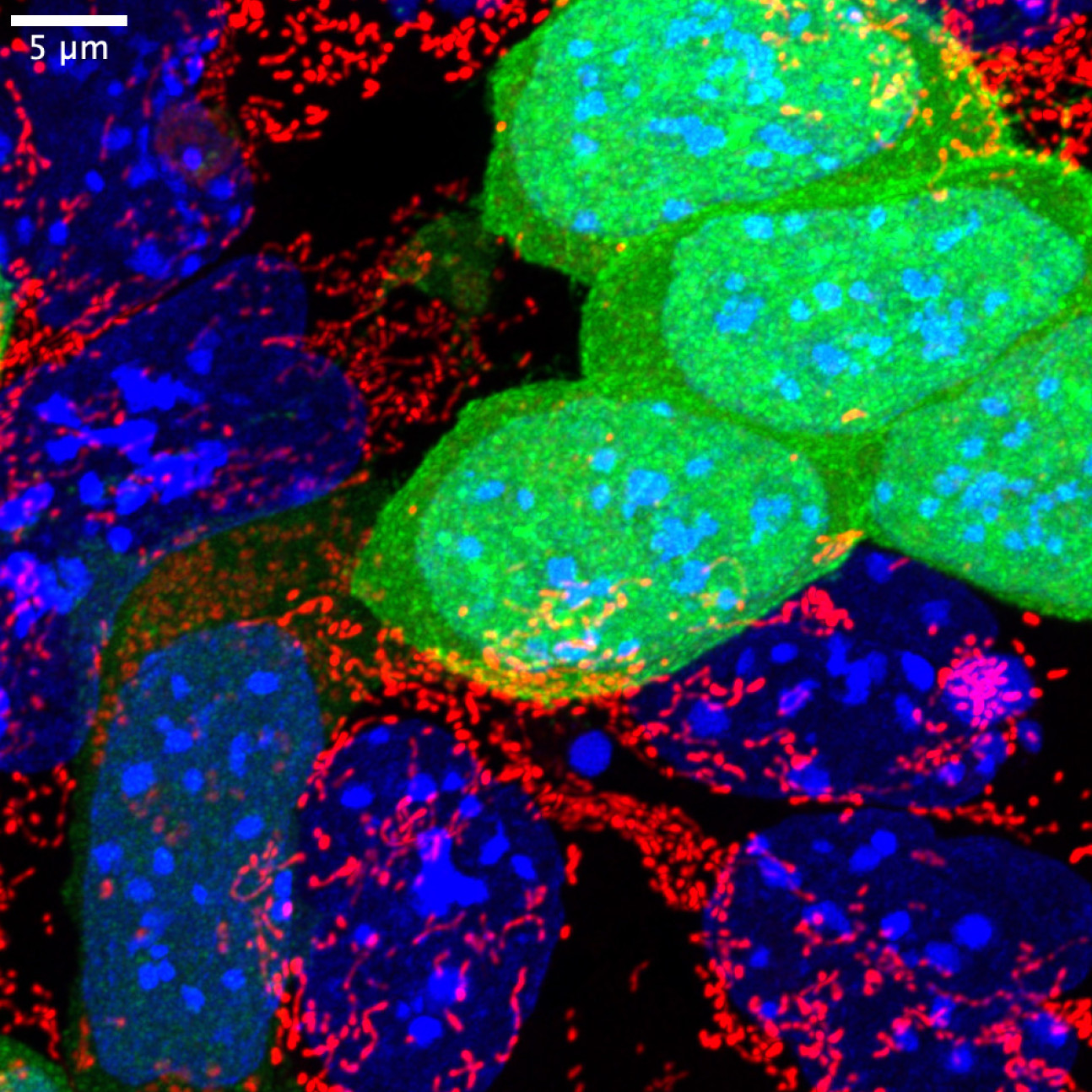 Embryonic stem cells with active mitochondria (labelled in red) and defective cells (labelled in green)
