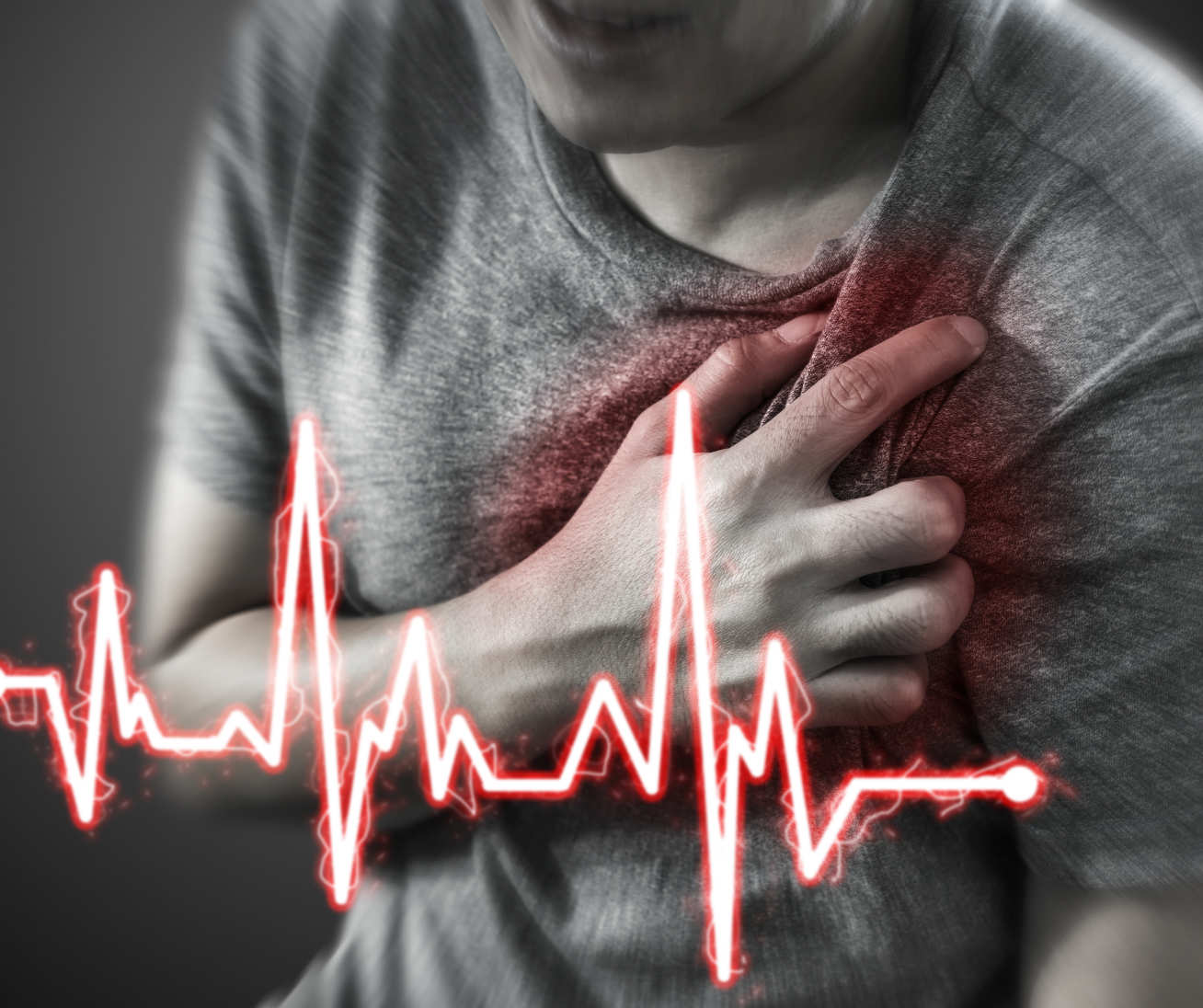 Heart attacks occur when blood supply becomes blocked with fatty substances