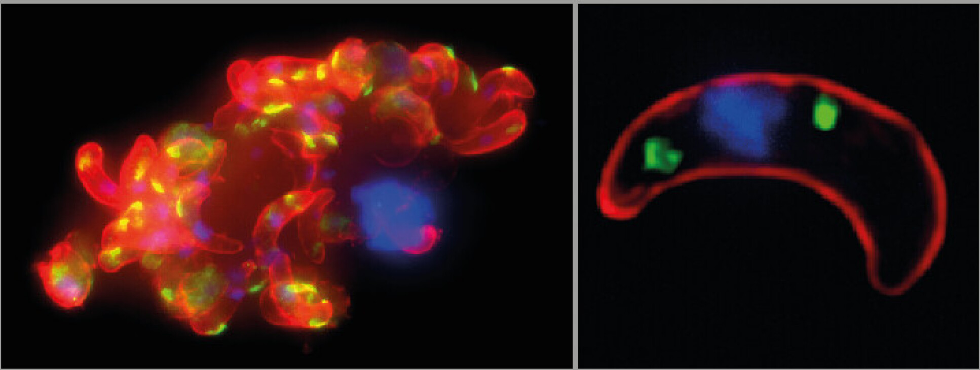 Two colourised images of malaria parasite cells