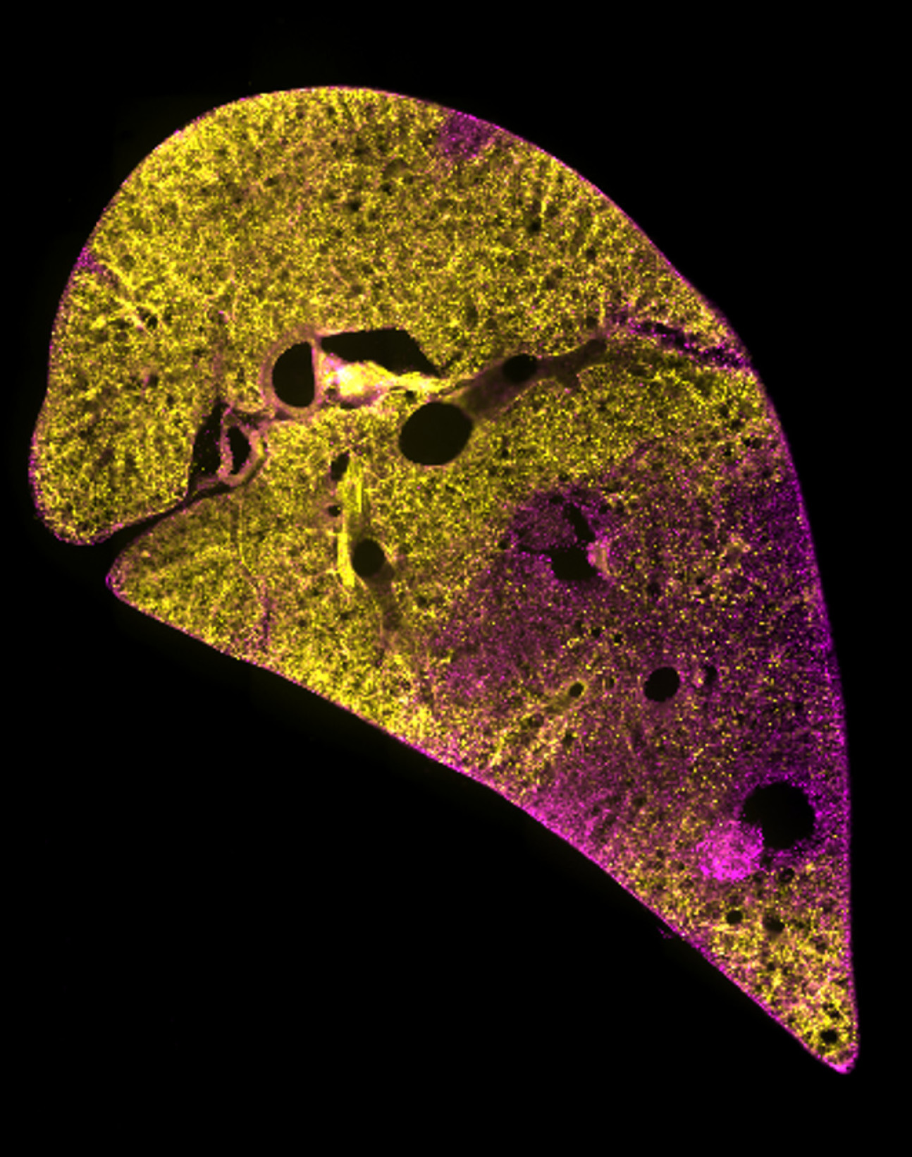 A cross section of a damaged lung