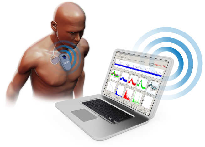 iPROBE, a digital 1k+ channel neural recording interface for neuroscience research