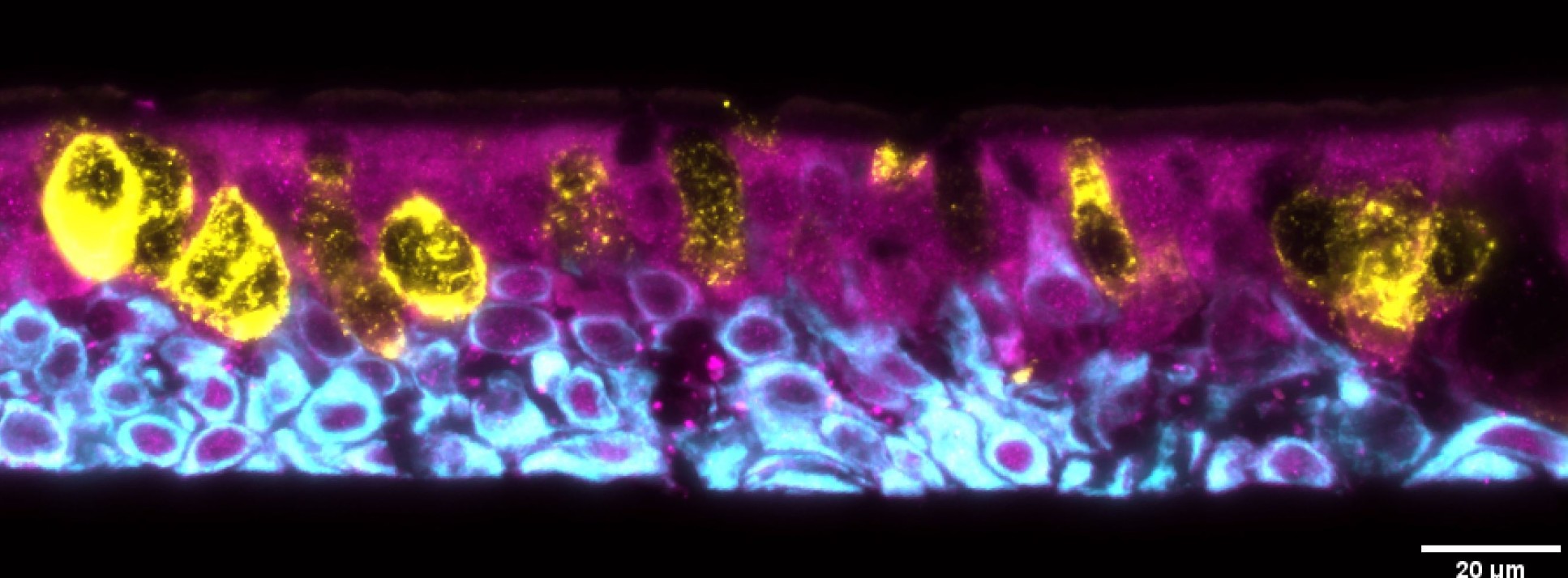 Lung scan