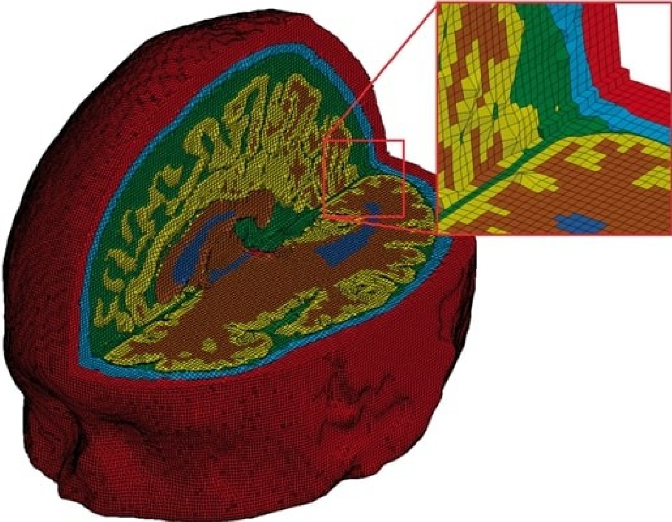 Picture of a brain being imaged