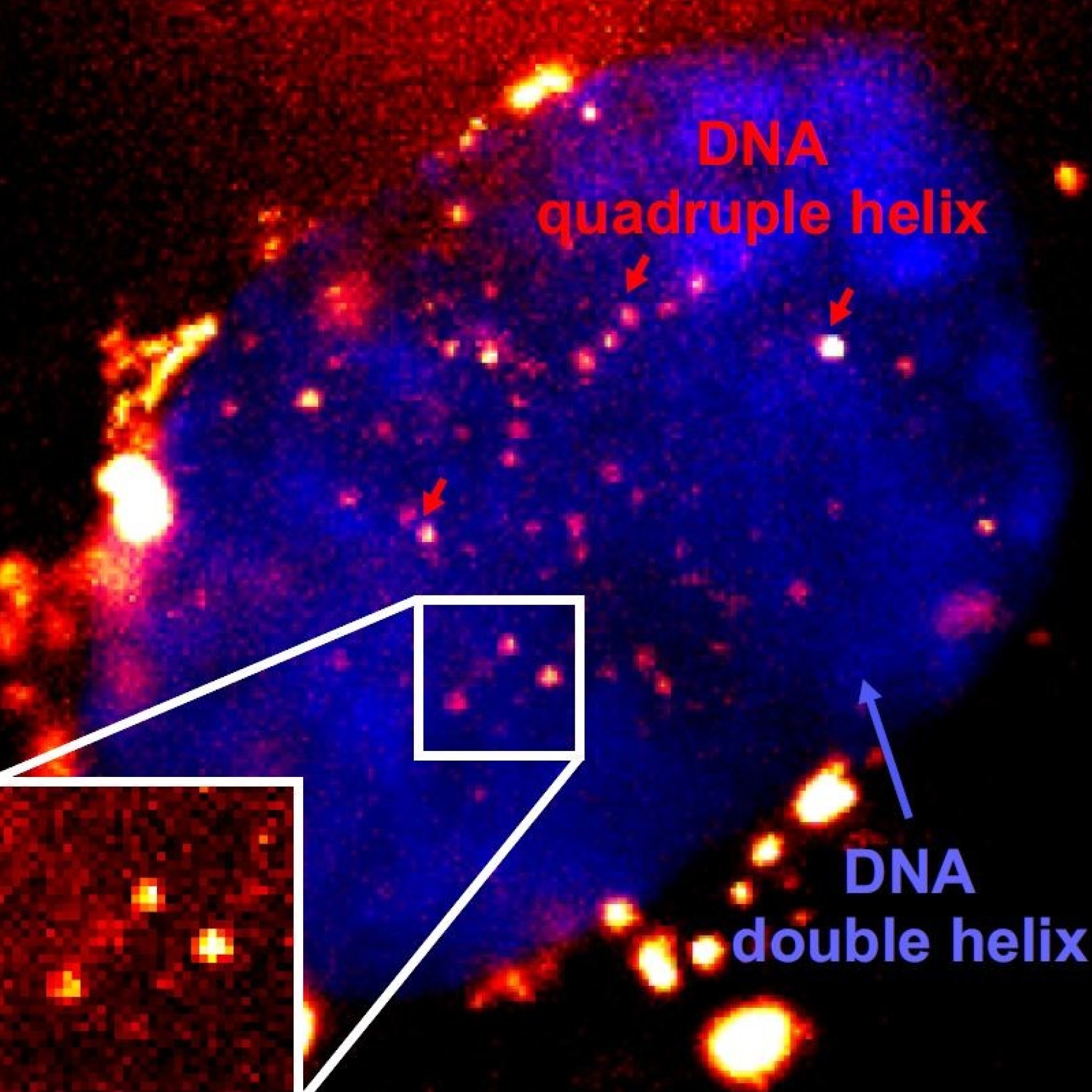 Microscopy image of quadruple helix DNA highlighted in yellow on a background of blue double helix DNA
